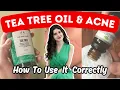 How To Use Tea Tree Oil For Acne Scars