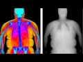 Advanced Body Composition
