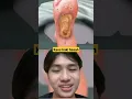Download Lagu KAOS KAKI BASAH #viral #shortsviral