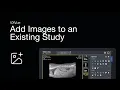 VXVue Software Tutorial How to Add Images to an Existing Study
