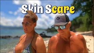 Tan lines and troubles: Has the Caribbean sun finally gotten to us?