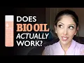BIO OIL Review by DOCTOR V Brown Dark skin stretch marks pigmentation how to use DR V