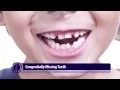 Congenitally Missing Teeth Abnormalities in Tooth Quantity - 3
