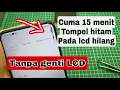 Download Lagu Menghilangkan tompel hitam pada lcd tanpa genti lcd baru