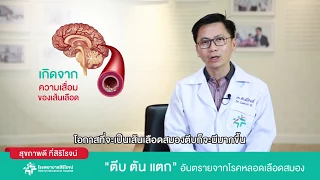 โรคเส้นเลือดสมองมีสาเหตุหลักมาจากอะไร และเกิดขึ้นได้อย่างไร