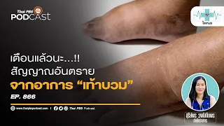 เท้าบวมหมายถึงบวมบริเวณไหนบ้าง