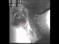 How to Identify Anatomical Landmarks on fluorscopy