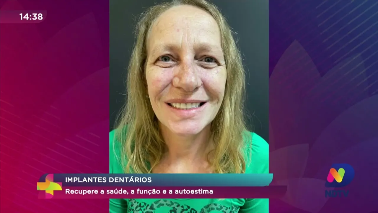 Implantes dentários: recupere a saúde, a função e a autoestima