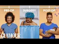 This is Your C-Section in 2 Minutes Glamour