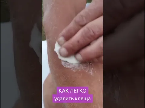 Народный способ удаления клеща... #народнаямудрость #здоровье#лечимся#клещи#удалениеклещей #мыло