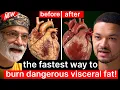 Download Lagu Insulin Doctor: The Fastest Way To Burn Dangerous Visceral Fat! This Is Clotting Your Blood!