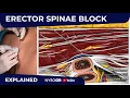 Erector Spinae Plane Block - Regional anesthesia Crash course with Dr. Hadzic