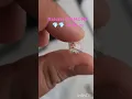 Download Lagu Natural Rough DIAMOND💎💎 14.24ct from(ETHIOPIA)🇪🇹@gemstonesdesires6445(Pls Like Subs)My YouTube▶️