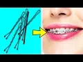 Download Lagu 35 BRILLIANT LIFE HACKS YOU NEED TO KNOW