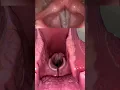 Download Lagu Live view of the vocal cords! #anatomy #medical #funfacts
