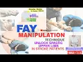 FAY MANIPULATION TECHNIQUE TO UNLOCK UPPER LIMB SPASTIC JOINTS IN PATIENTS