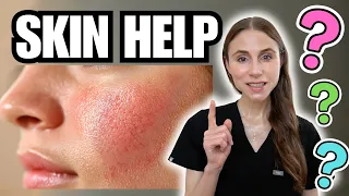 Dermatologist Q&A: Everyday Skin Problems Explained