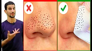 اسهل طريقة لازالة الرؤوس السوداء بالمنزل في دقائق 