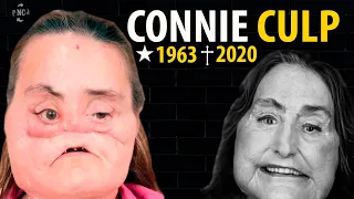 DIÁRIO DOS M0RT0S - Connie Culp, MULHER que fez HISTÓRIA com seu NOVO ROSTO