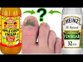What is Better For Toenail Fungus - White Vinegar or Apple Cider Vinegar