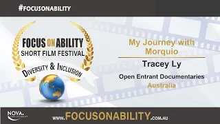 My Journey with Morquio film thumbnail