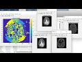 Canny edge detection in Matlab code to detect edges Edge detection matlab