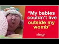 Why I didn t Abort My Babies with Anencephaly