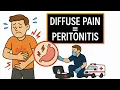 NREMT Abdominal Emergencies Understanding Peritonitis