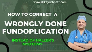 Download Haller's Myotomy after reversal of Nissan's Fundoplication MP3