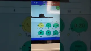 شرح طريقة ضبط جهاز التنفس في العناية المركزة لحالات الفشل الرئوي الجزء الثاني 