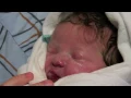 Download Lagu Prader-Willi Syndrome... A Mother's Perspective