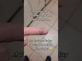Bruised Finger