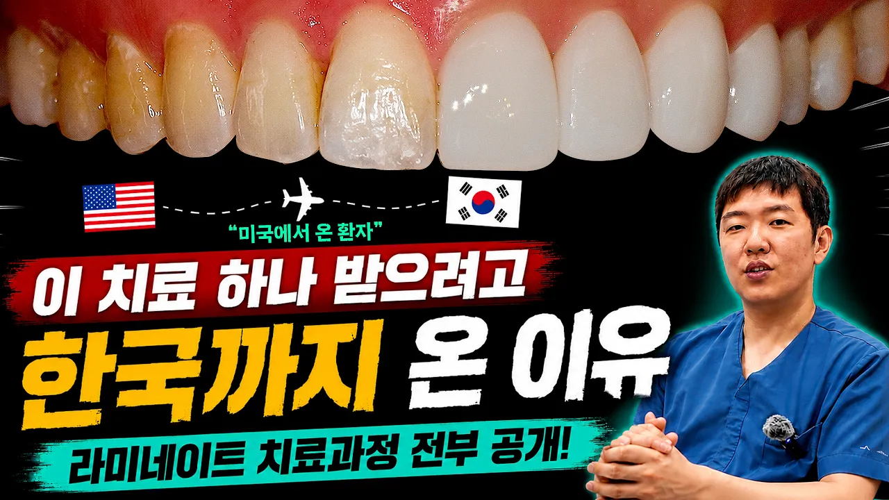 무삭제 리얼네이트 시술 과정 전부 공개 100%리얼🌟 (with.미국환자)