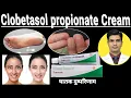 Clobetasol Cream ip tenovate Clobetasol propionate cream