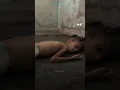 Download Lagu Child in Gaza suffers neurological disorders from severe malnutrition