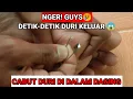 Download Lagu NGER! GUYS😥 DETIK-DETIK KELUARNYA DURI DI DALAM DAGING #fypシ #cabutduri #splinter  