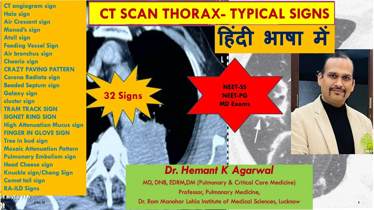 CT SCAN THORAX (हिंदी भाषा में) Typical Named Sign for Exams #NEET SS, #NEET-PG @Dr.Hemant K Agarwal