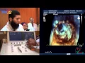 How to perform 3D-TTE exam a step by step approach