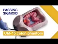 Basic Techniques of Colonoscope Insertion Ex 3 Passing sigmoid colon without abdominal compression
