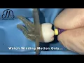 How to Achieve Patency during Root Canal Treatment using One Manual File Double Curvature Canal