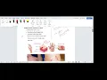 ICD-10 - Coding of Wound-Part 1