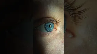 EASY WAY To Get Sharp Photos Of Your Eye Iphonephotography Mobilephotography Macrophotography 