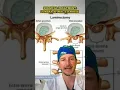 Spinal Stenosis SURGERY explained at a 5th grade level