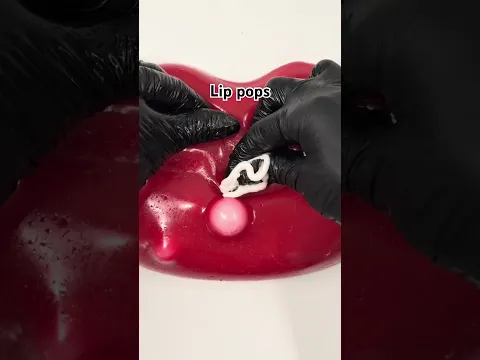 The Most Satisfying Pimple Pop Ever 😳💥 | Pimple Popping ASMR #asmr #shorts