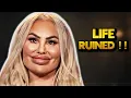 Darcey Silva Gets Saddle Nose Deformity Due To Extreme Plastic Surgery