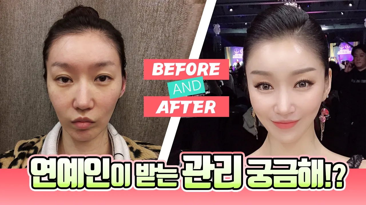 #임영민원장 카메라 앞에서도 당당하게! 연예인이 관리하는 방법! 리프팅, 지방이식, 쁘띠 수술전후 리얼스토리