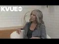 Doctor discusses taking a holistic approach to chronic illness