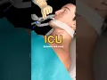 Download Lagu What happens in ICU ?