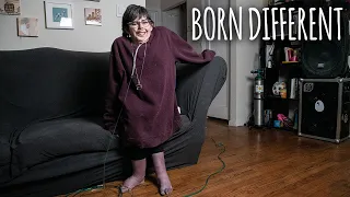 Download I Was Born With A Third Arm On My Head | BORN DIFFERENT MP3