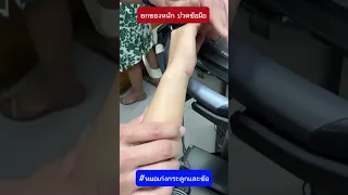 อาการปวดข้อมือที่เกิดจากการยกของหนักและเจ็บเวลาหงายมือหรือคว่ำมือ อาจเกิดจากสาเหตุอะไร?